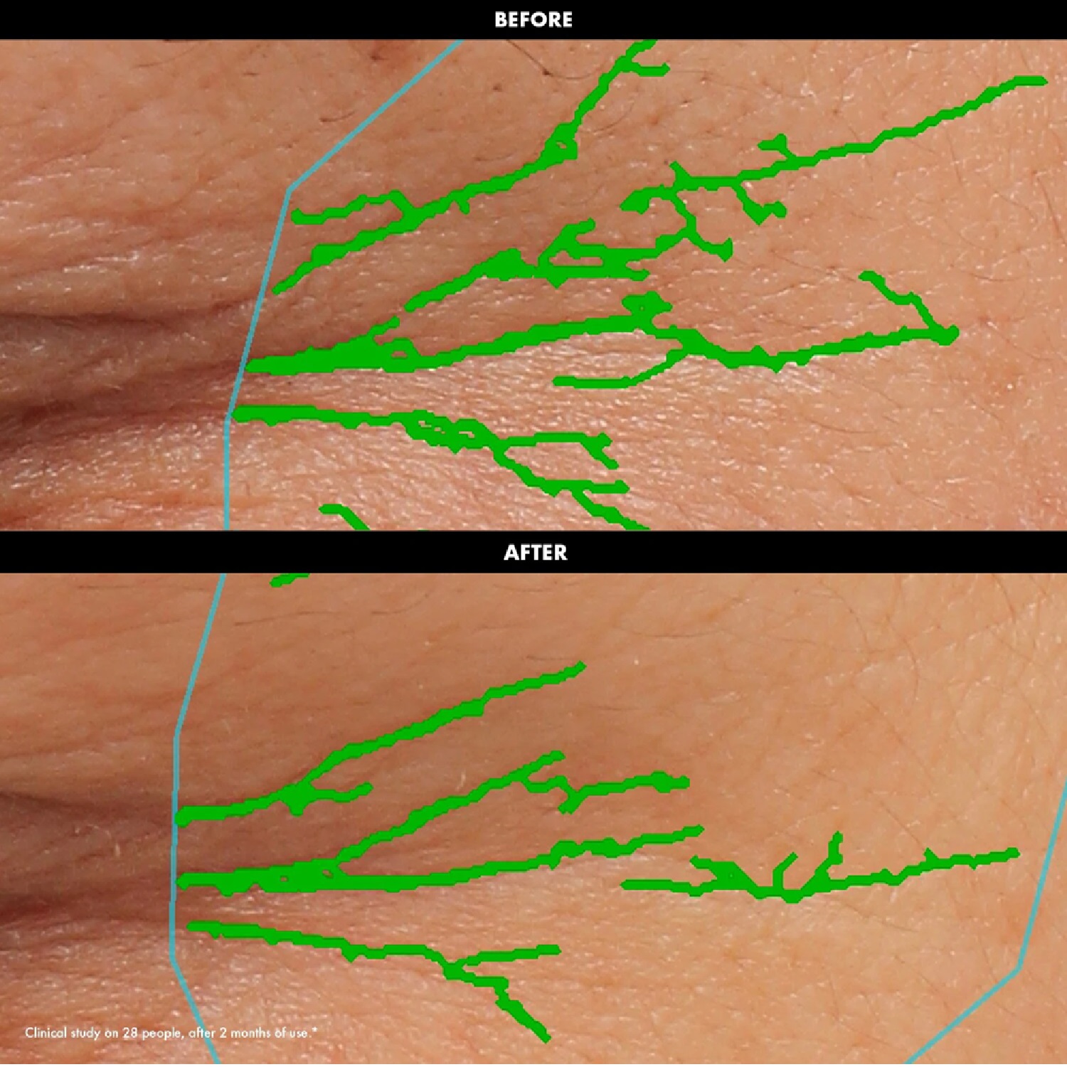 LIFT & FIRM CREMA DE OJOS ALISADORA Y REAFIRMANTE (CREMA PARA CONTORNO DE OJOS)